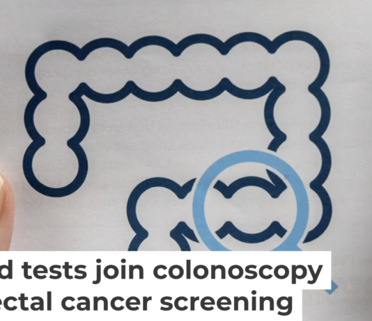 Screening is essential to prevent and effectively treat colorectal cancer. Varlay/iStock via Getty Images Plus